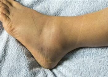 خبير طبى عالمى : المصريون يعيشون فى دوامة من الأمراض الوبائية 2025