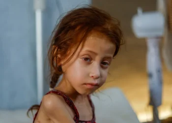 إسرائيل تقتل الطفولة في غزة: 70 ألف طفل يواجهون الجوع وسوء التغذية 2025