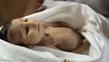 من هى غدير بريكة ؟ …صورة جثمان رضيعة فلسطينية زلزلت الكونجرس الامريكى 2025