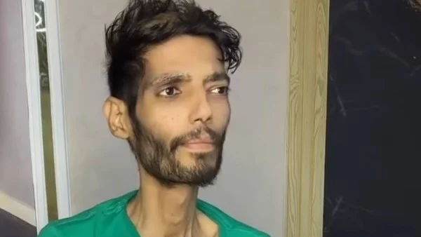 حضر بصحبة فنانة وادعت جمع تبرعات له … وزارة الصحة المصرية تحسم الجدل بشان وفاة شيكا 1 حضر بصحبة فنانة وادعت جمع تبرعات له … وزارة الصحة المصرية تحسم الجدل بشان وفاة شيكا 2025