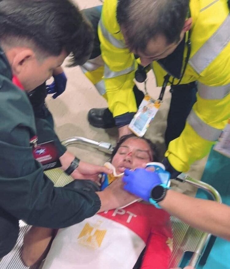 سقوط عنيف ينهي مشاركة ابتسام زايد لاعبة منتخب مصر للدراجات في بطولة العالم بتشيلي.. ونقلها للمستشفى 1 سقوط عنيف ينهي مشاركة ابتسام زايد لاعبة منتخب مصر للدراجات في بطولة العالم بتشيلي.. ونقلها للمستشفى 2025