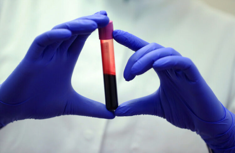 50 شخصًا فقط يحملونه.. سباق عالمي لإنتاج الدم الذهبي في المختبرات 2025